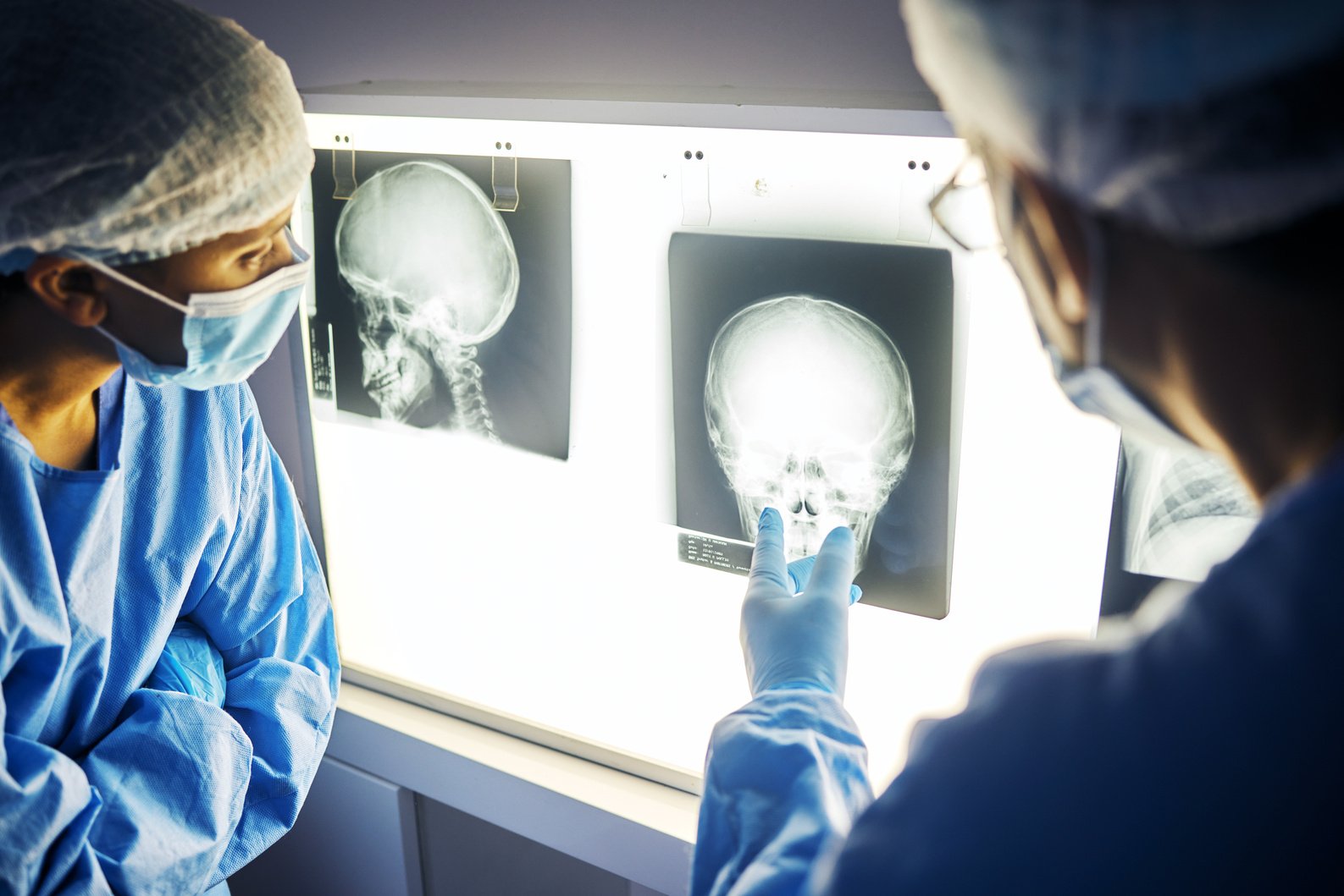 Skull  Ray, Screen and Doctor with Analysis of Scan, Healthcare and Surgery with Medical Team and Neurology. Radiology, Assessment and Plan with People in Hospital, Surgeon and Medicine with Anatomy